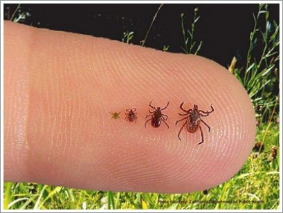  เห็บตัวเล็กๆ ก็ทำให้ถึงแก่ชีวิตได้